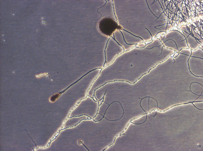 Fungus as cell culture contamination